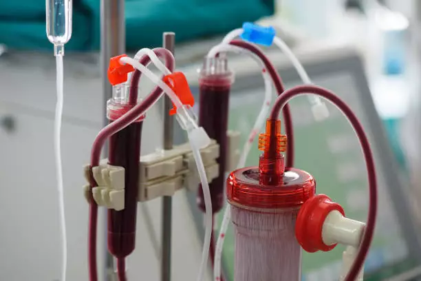 Home Dialysis Systems Market Expected to Expand Significantly at a 10.7% CAGR