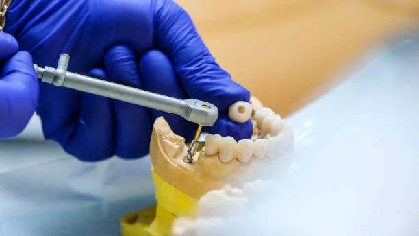 Titanium Dental Implants Market Forecasted to Grow at an 11.0% CAGR by 2035